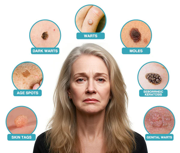 Viral Laser Eraser Pen