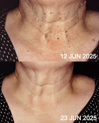 Viral Laser Eraser Pen